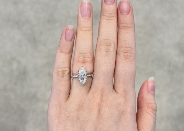 A Ring That’s Too Tight